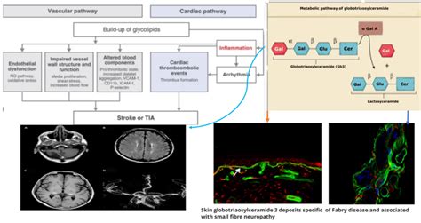 Pathogenetic Mechanisms Of Central And Peripheral Nervous Complications