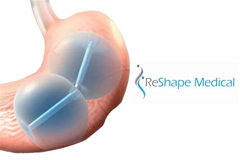 Weight loss: ReShape Medical closes $6.75M funding round - MassDevice