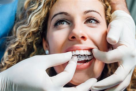 Invisalign Images Dental Centre