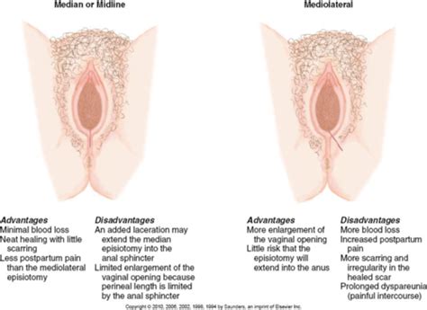 Intrapartum Stage Of Labor Test Flashcards Quizlet