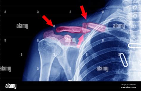 Radiologie Strahlung Hot Sex Picture