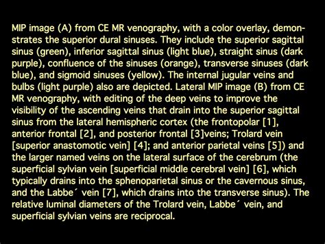 MRI BLOG: Dural Sinus Thrombosis