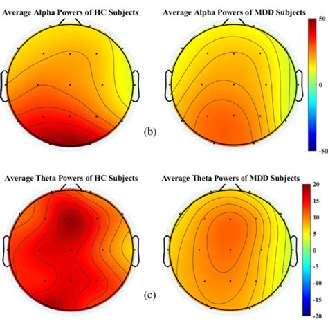 The Scalp Topographic Plots Of Average Powers Of Delta A Alpha B