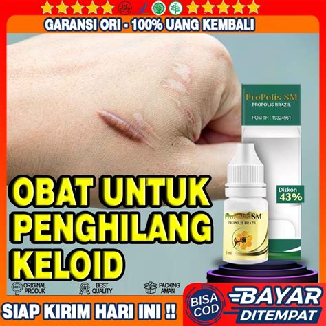 Jual Obat Keloid Obat Penumpas Daging Tumbuh Daging Jadi Penghilang