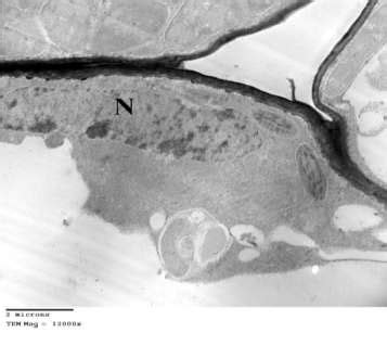 Electron Micrograph Of Ultrathin Section Of Cell Of Infected Hyoscyamus