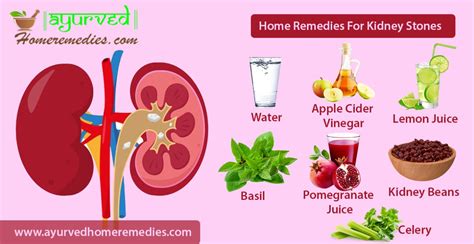 Home Remedies To Treat Kidney Stones | How to Remove Kidney Stones ...