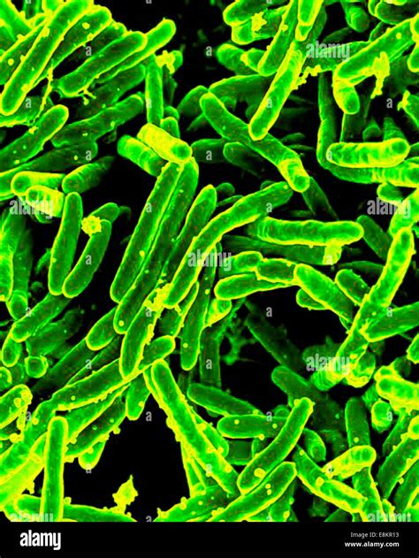 Micrograf A Electr Nica De Mycobacterium Tuberculosis La Bacteria Que