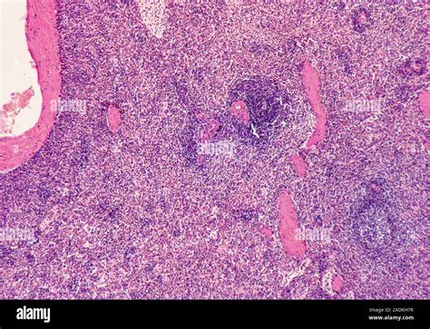 Light Micrograph Of Normal Human Spleen The Spleen Is A Lymphoid Organ