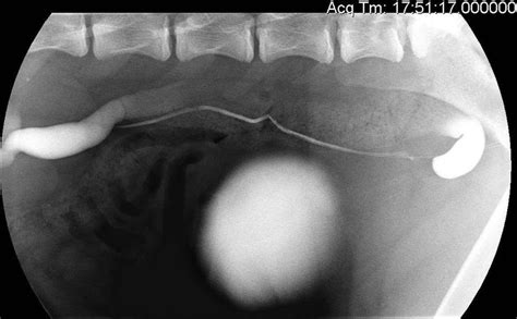 Fluoroscopic Image Of A Positive Contrast Retrograde Ureterogram The