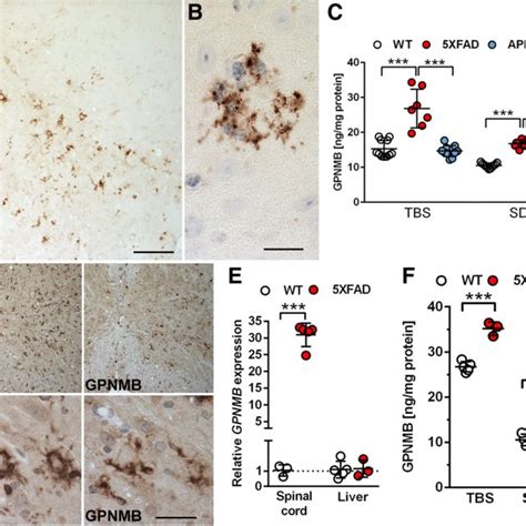 GPNMB IBA 1 Positive Microglia Cells Cluster Around Individual Plaque