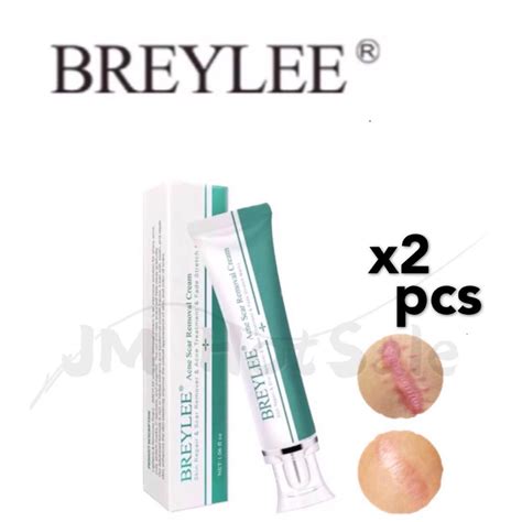 JM 2pcs BREYLEE Acne Scar Removal Cream 30g Face Cream Skin Repair