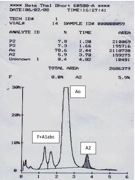 Laboratory Diagnosis Of β Thalassemia And Hbe Intechopen