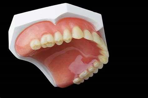 Natural Looking Dentures North Street Dental