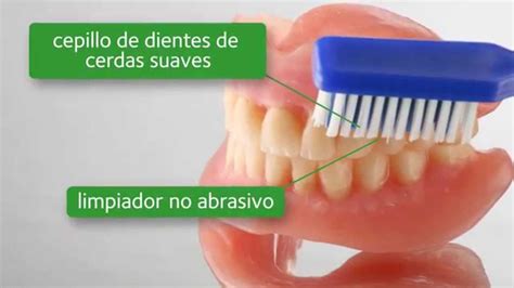 Premio Lucha C Ntrico Desinfectar Protesis Dental Cobre Para Jugar Volumen