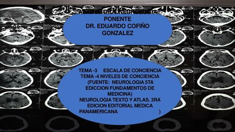 Escala de conciencia y niveles de conciencia Neurología Eduardo