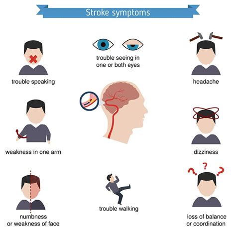 view stroke signs