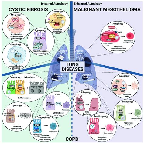 Autophagy Dysregulation In Lung Disease Progression Representation Of