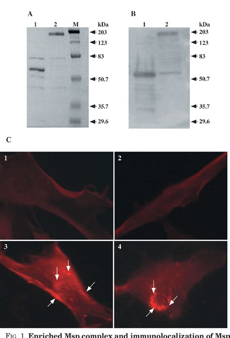 Figure 1 From A Spirochete Surface Protein Uncouples Store Operated