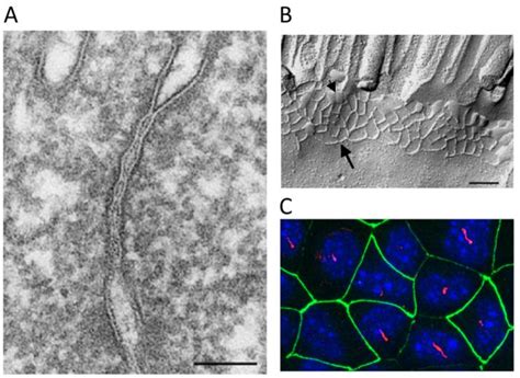 Table From Role Of Zonula Occludens Zo Proteins In Regulating