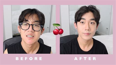 Asian Guy Before And After Makeup | Saubhaya Makeup