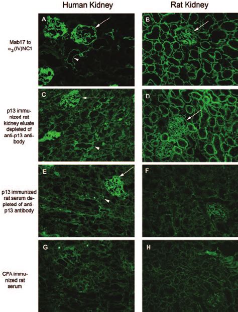 Indirect Immunofluorescence On Normal Human A C E And G And Rat