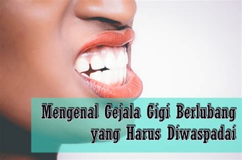 Mengenal Gejala Gigi Berlubang Yang Harus Diwaspadai Riset