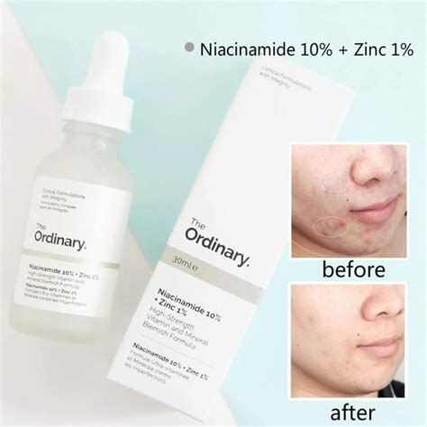 The Ordinary Niacinamide Zinc Original Serum Meses Sin Intereses