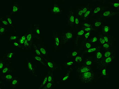 Anti Slco C Antibody Rabbit Pab T Sino Biological