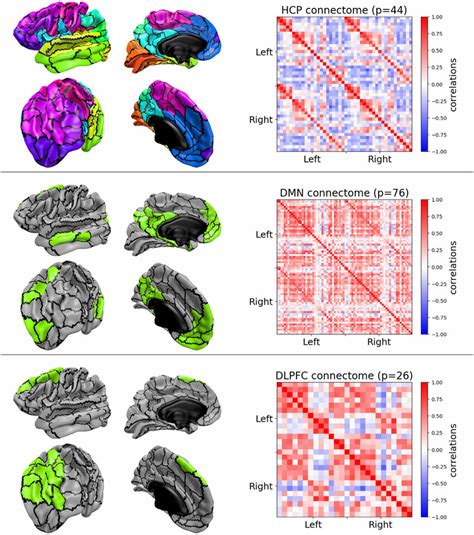 Functional Networks Considered In This Work And Displayed On The