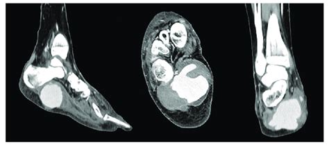 Multiplanar Computed Tomography Ct Reconstruction Detailed Legend Download Scientific