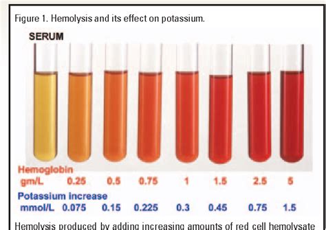 The Effects Of Varying Mg And Si Levels On The