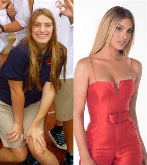 Antes Y Despu S Lele Pons Mostr El Incre Ble Cambio De Su Cara Y Su