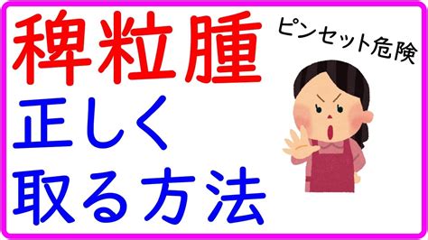 稗粒腫（はいりゅうしゅ）自分で取る方法【絶対】ピンセットで取らないで！ Youtube