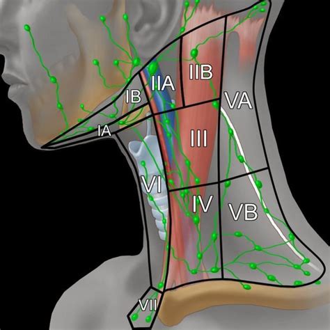 Low Power Image Of A Lymph Node Containing Metastatic Squamous Cell Download Scientific Diagram