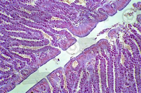 Gallus Gallus Domesticus Chicken Stomach Transverse Section 250x