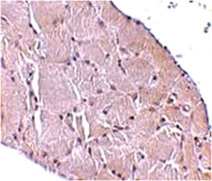 Anti Wnt A Antibody From Rabbit Purified By Affinity Chromatography