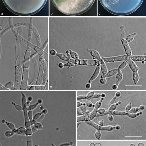 Trichoderma Anisohamatum YMF 1 00333 A C Cultures After 7 D At 25