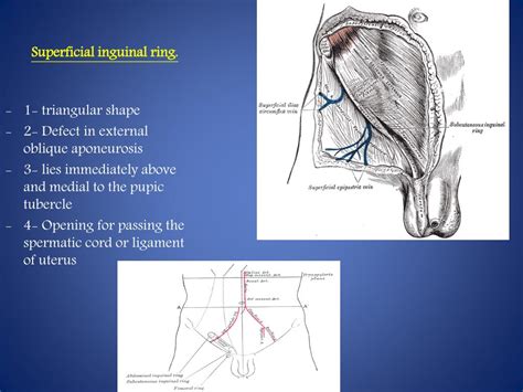 The Superficial Inguinal Ring