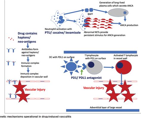 Figure 1 From Drug Induced Vasculitis Semantic Scholar