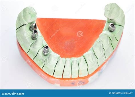 Dental Prosthesis Isolated Stock Image Image Of Teeth 24355035