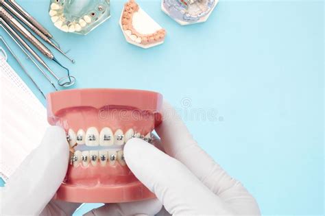 Ferramentas Do Dentista E Modelo Ortod Ntico Imagem De Stock Imagem