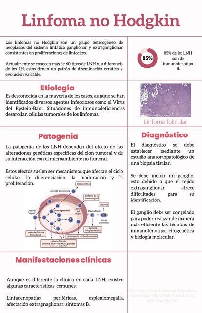 Linfoma No Hodgkin Iv N Ayala Collado Udocz