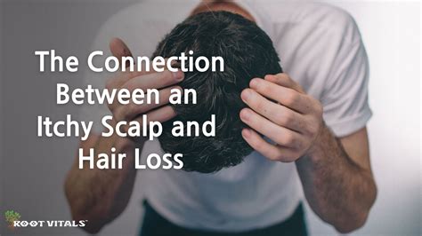 The Connection Between An Itchy Scalp And Hair Loss