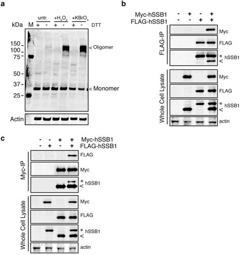 Hssb Nabp Obfc B Is Regulated By Oxidative Stress Pmc