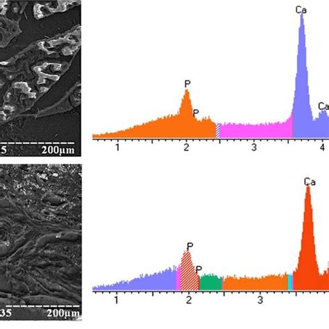 Sem With X Ray Microanalysis A Pgb Wall And Energy Dispersive X Ray