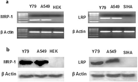 Expression Study Of MDR MRNA And Proteins Expression Of LRP And MRP 1