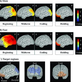 Cortical T Maps Showing Regions Of Significant Standardized Cortical