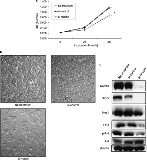 Effects Of Notch1 Small Interfering Rna Sirna On The Proliferation Of Download Scientific