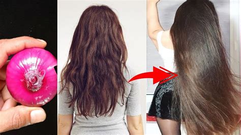 How To Grow Hair Very Fast In 1 Week Grow Hair Naturally Remedies