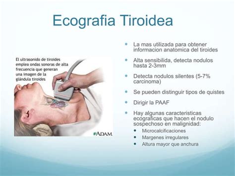 PATOLOGÍA TIROIDEA CLASIFICACIÓN PPT Descarga Gratuita